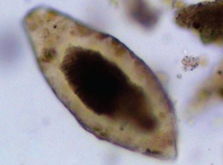 Археологи обнаружили паразитов в могиле ребенка, жившего 6000 лет назад