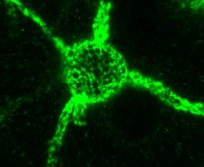 Белковое покрытие нейронов оказалось ключом к долгой памяти