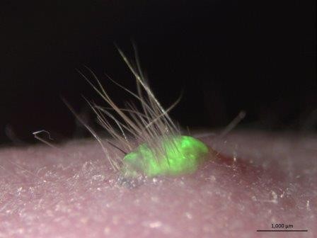 Японские ученые вырастили полноценную кожу из стволовых клеток