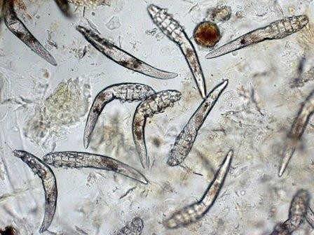 Микроскопические клещи рассказывают о происхождении своих хозяев