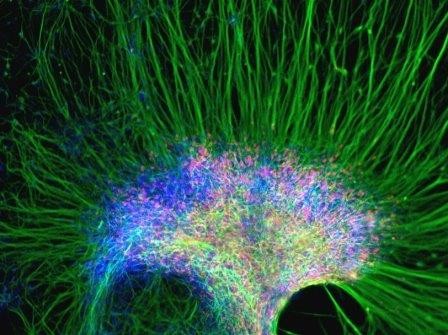 На мягких поверхностях стволовые клетки превращаются в нейроны