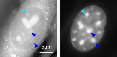 Новый тип микроскопа позволил рассмотреть хромосомную «темную материю» внутри живых клеток