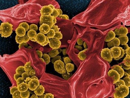 Обнаружены новые гены устойчивости к антибиотикам