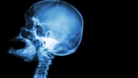 Ученые нашли гены, управляющие размерами черепа человека