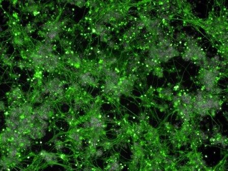 Ученые превратили клетки крови в нейроны