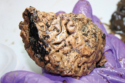 В древнем черепе нашли неповрежденный человеческий мозг